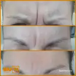 Clínica de Medicina Estética BiutiBox - Bild 3