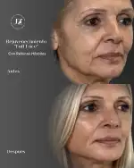 Dr. Juan Zarate - Bild 10