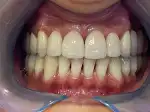 Clínica Dental Llibertat - Imagen 7