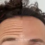 Dra. Salomé Pelle | Clínica Estética y Medicina Estética - Bild 10