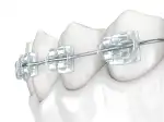 Clínica Dental Castañer - Bild 7
