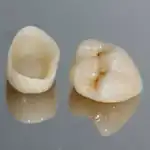 Clínica Dental Castañer - Bild 9