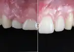 Clínica Dental Franch-Adriaens Odontología Avanzada - Bild 7
