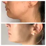 Clínica One Face - Bild 3