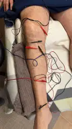 Centro Raul Martinez Osteopatía & Acupuntura - Bild 4